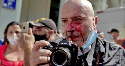 el español Ramón Espinosa, de Ap agredido por la policía cubana.jpg